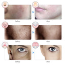 Máscara Facial LED Recarregável – Terapia de Luz